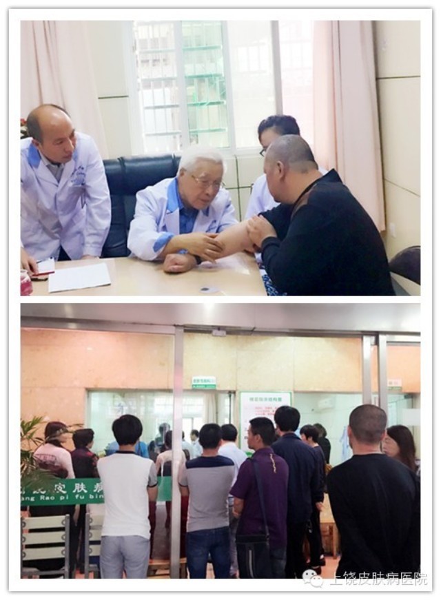 王俠生教授在上饒皮膚病醫(yī)院會(huì)診